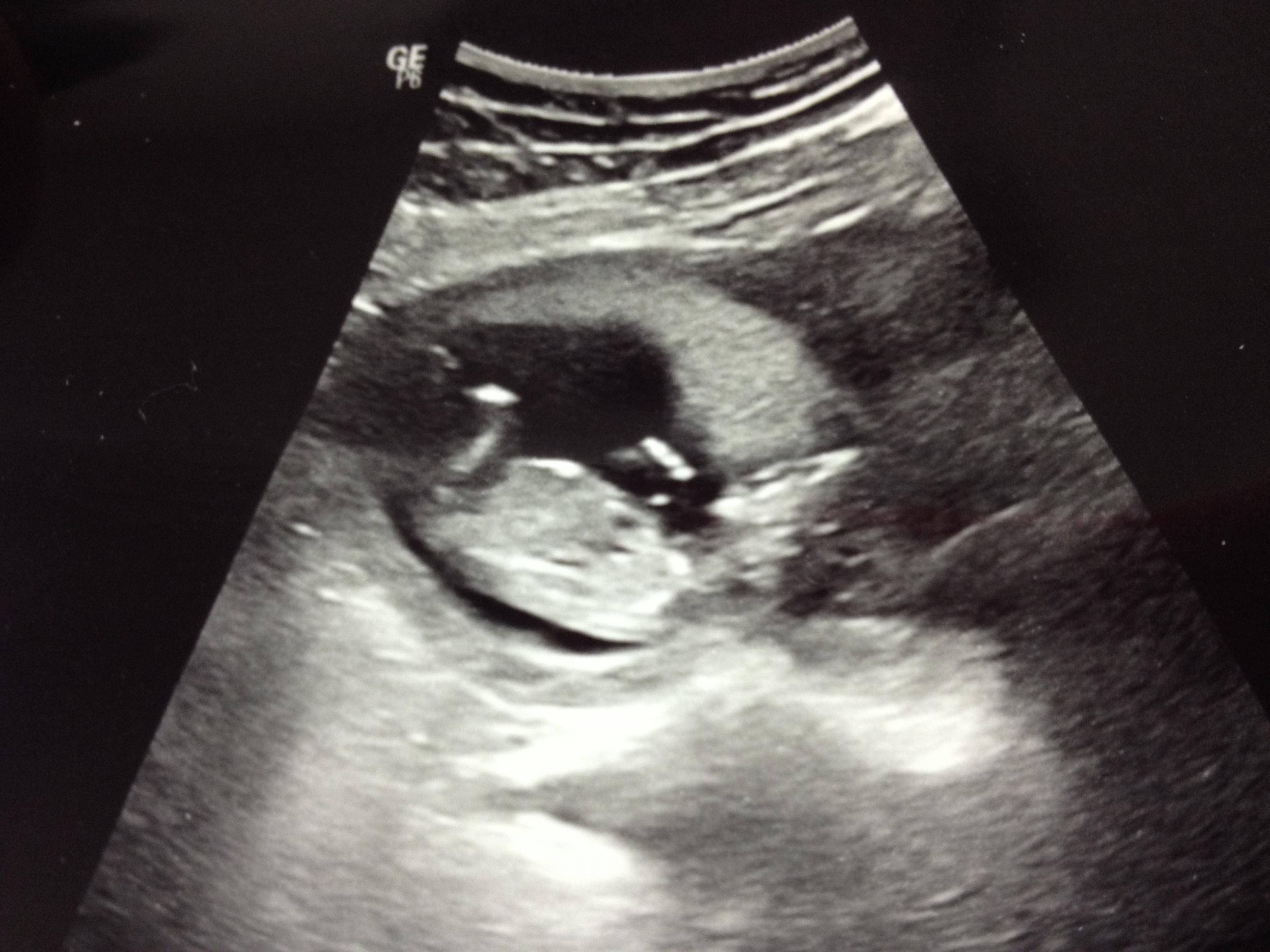 Name:  IMG_4028.JPG
Views: 221
Size:  1.62 MB