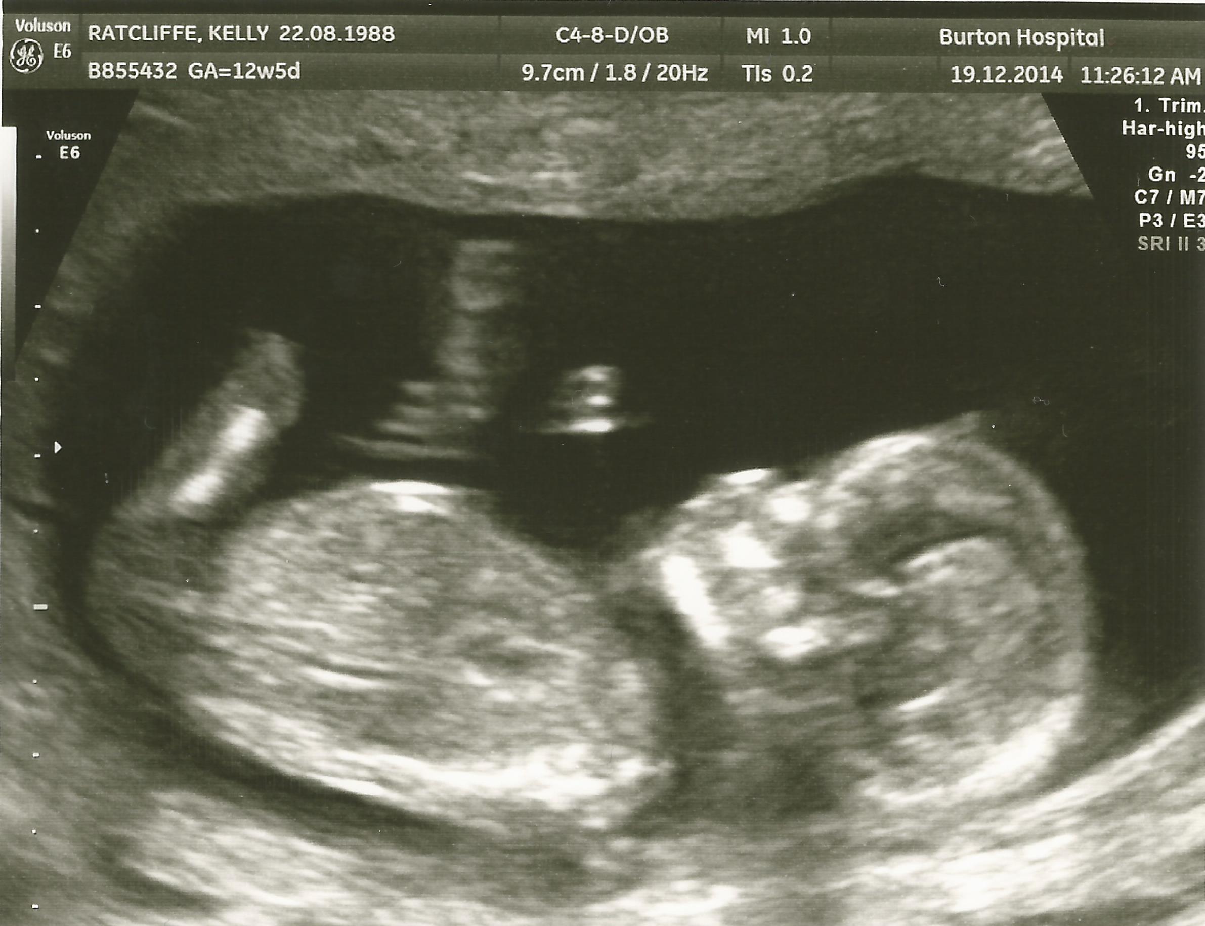 Name:  Scan20.jpg
Views: 275
Size:  313.0 KB