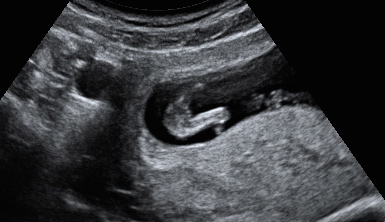 Name:  BABY 11WKS_8.JPG
Views: 664
Size:  46.2 KB