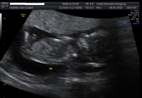 Name:  Scan1.jpg
Views: 884
Size:  48.7 KB