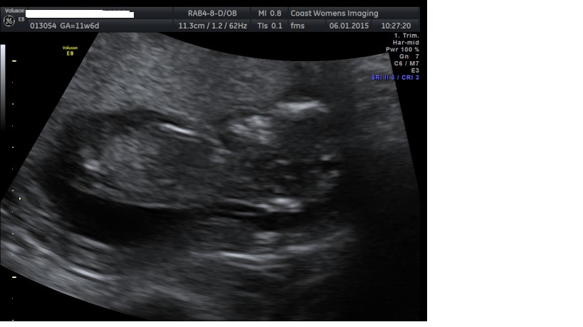 Name:  scan 2.jpg
Views: 1118
Size:  61.0 KB