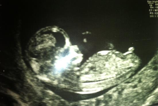 Name:  Baby.jpg
Views: 6177
Size:  22.8 KB