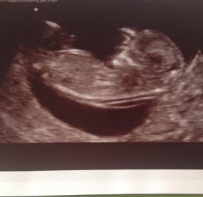 Name:  Baby 2015.jpg
Views: 260
Size:  9.0 KB