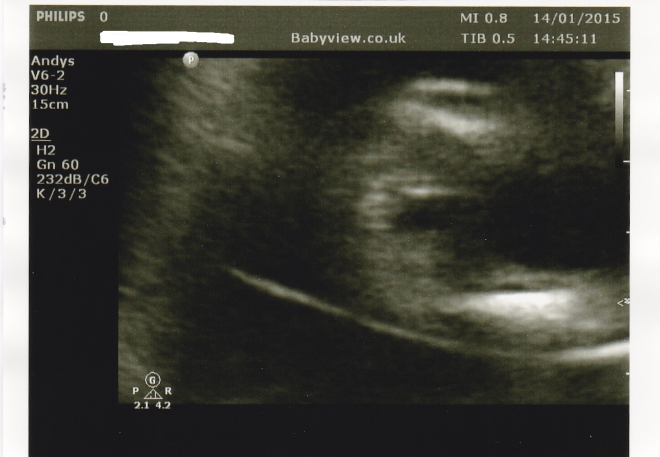 Name:  twingirlpottyshot - Copy.jpg
Views: 99
Size:  195.6 KB