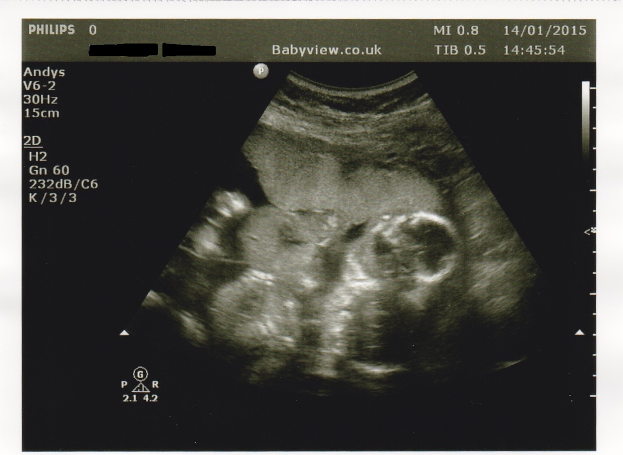 Name:  TwinsCheek2cheek - Copy.jpg
Views: 149
Size:  190.3 KB