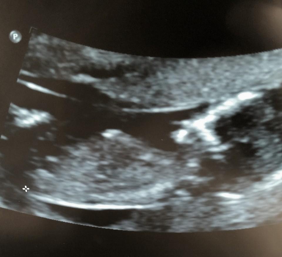 Name:  baby 8 2015.jpg
Views: 134
Size:  54.9 KB