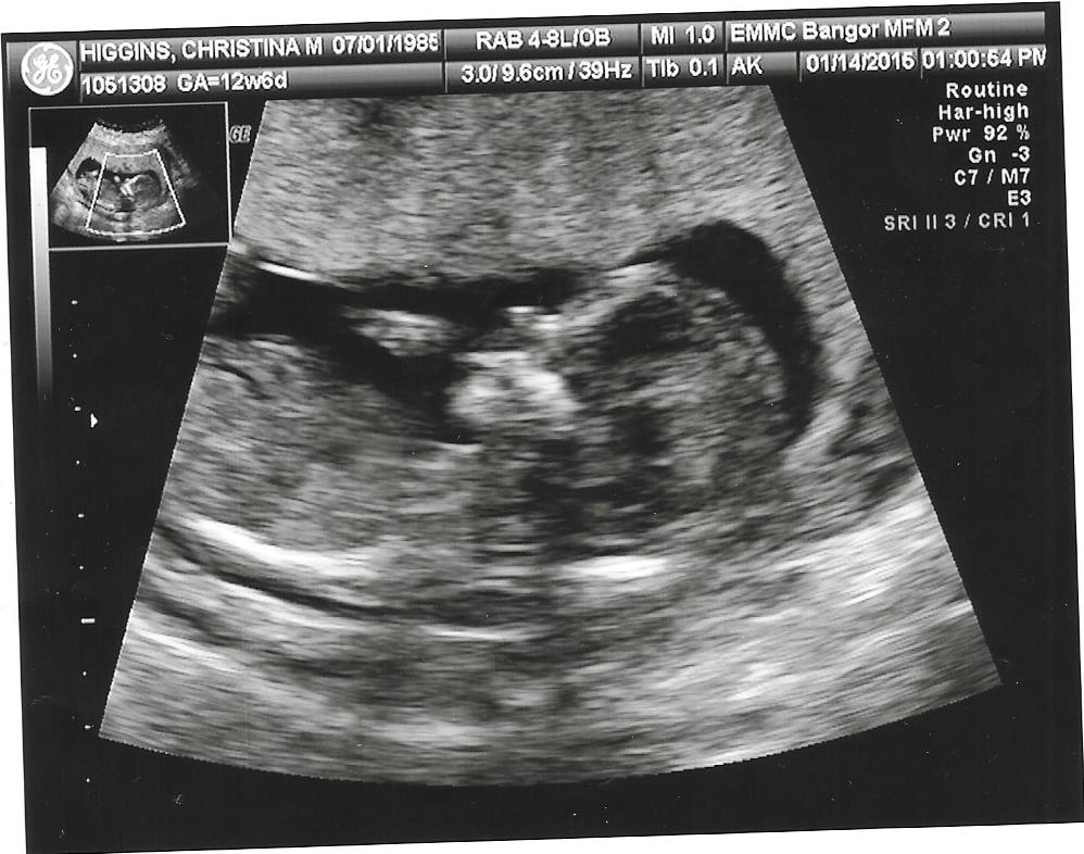 Name:  Scan0002.jpg
Views: 559
Size:  112.2 KB