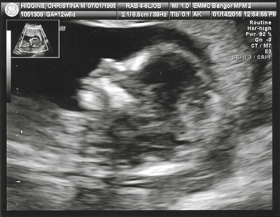 Name:  Scan0003.jpg
Views: 591
Size:  98.4 KB