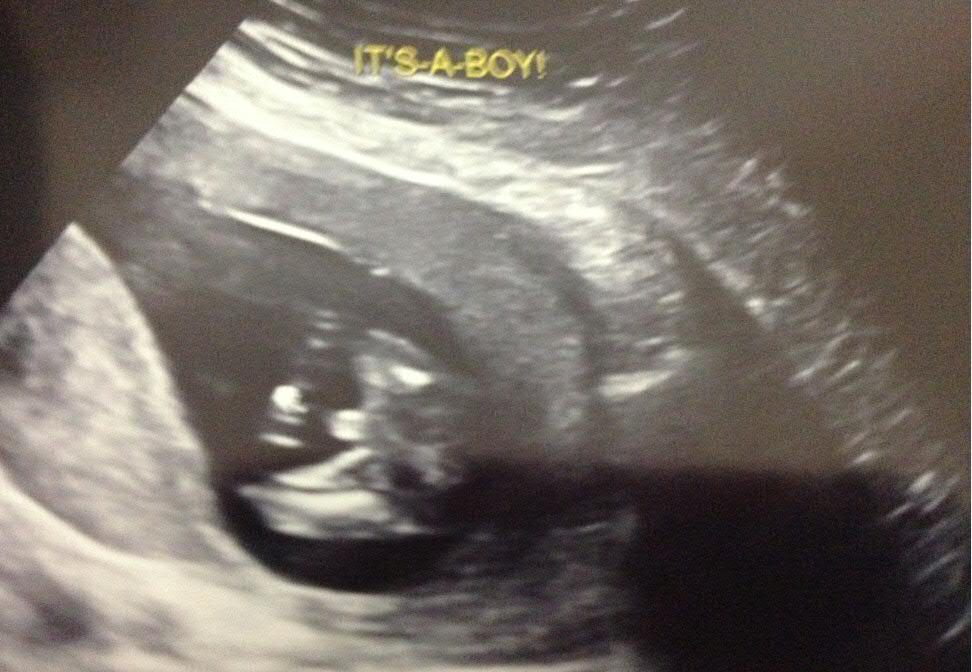 Name:  15weeks.jpg
Views: 1300
Size:  91.8 KB