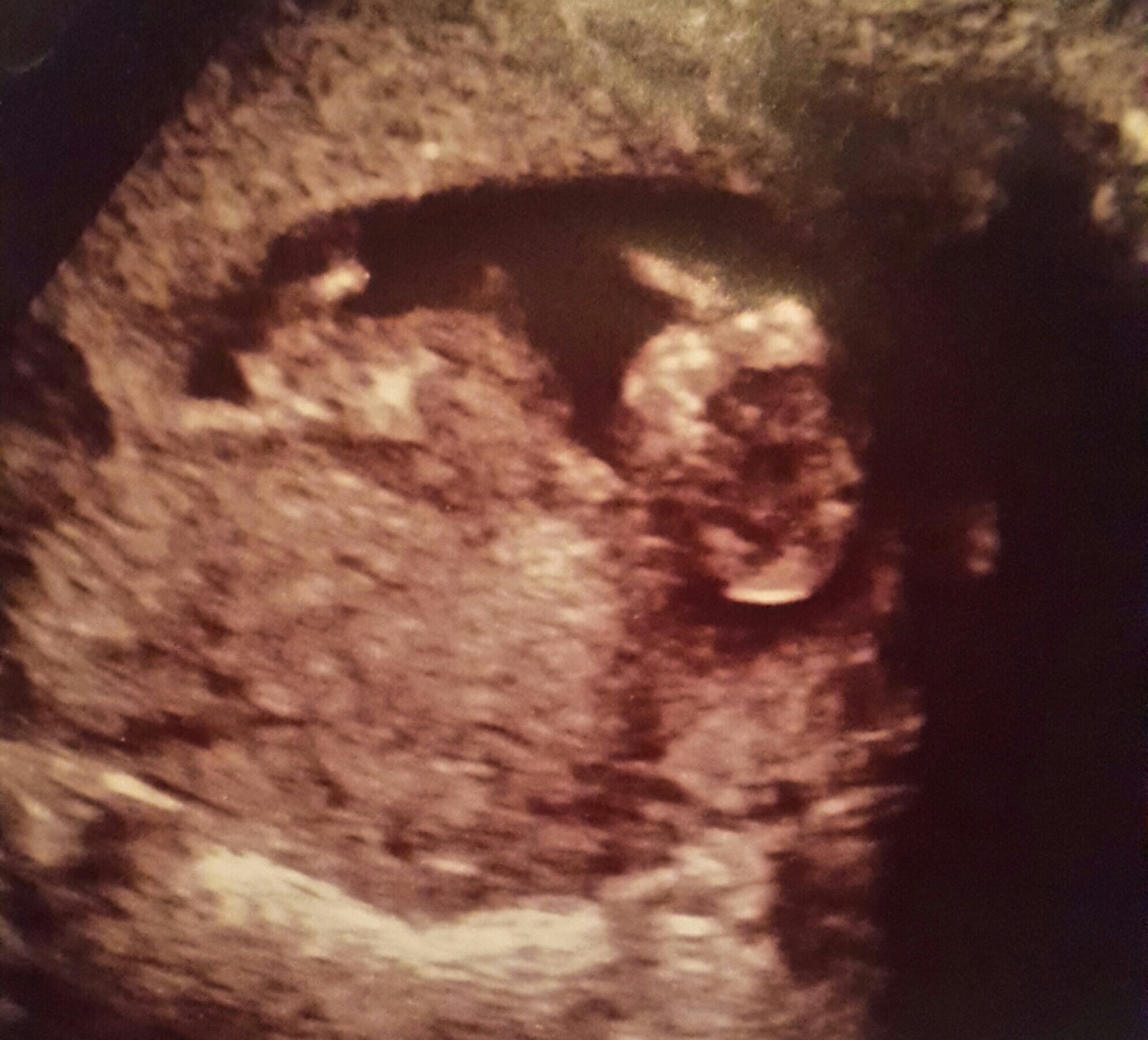 Name:  babyscan.jpg
Views: 475
Size:  2.16 MB