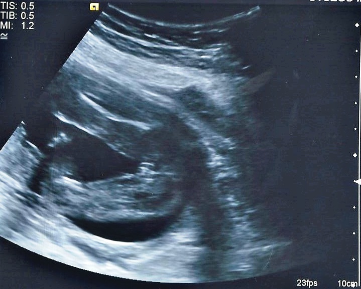 Name:  PhotoScan (3).jpg
Views: 1298
Size:  112.5 KB