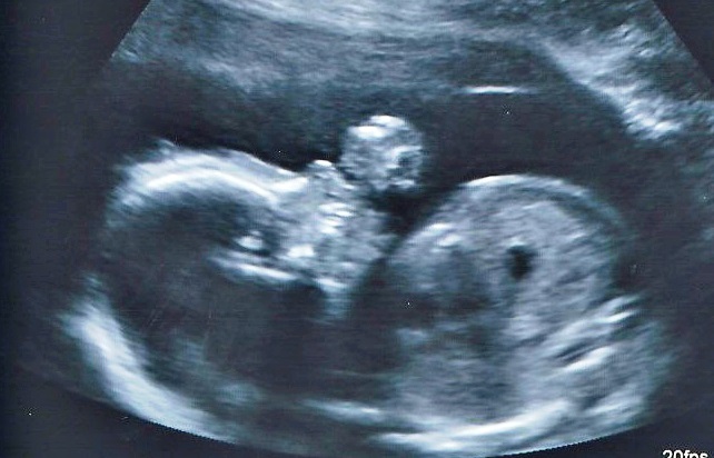 Name:  PhotoScan.jpg
Views: 1216
Size:  76.5 KB