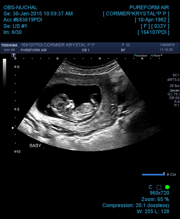 Name:  OBS-NUCHAL_20150130_115247.jpg
Views: 172
Size:  183.3 KB