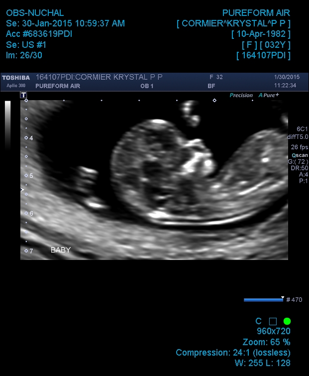 Name:  OBS-NUCHAL_20150130_115312.jpg
Views: 745
Size:  169.8 KB
