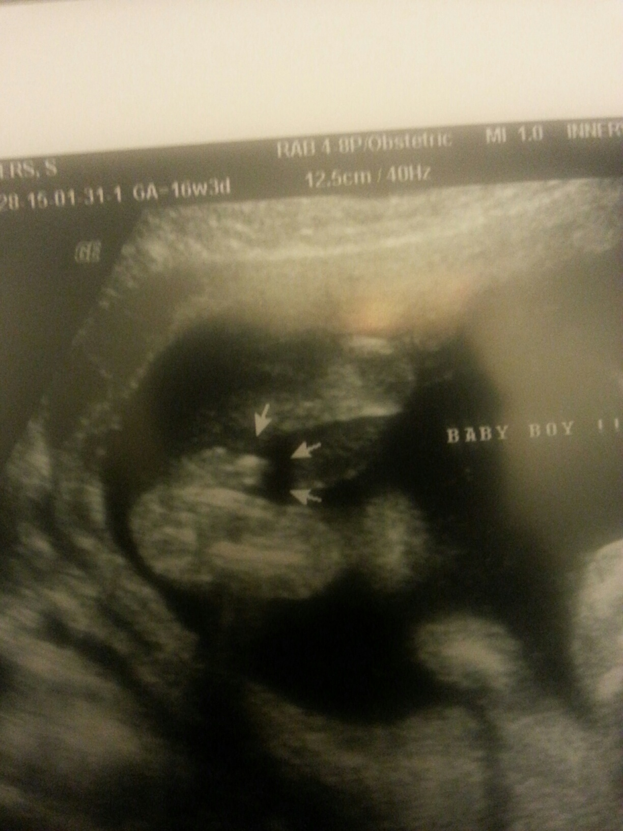 Name:  boy parts.jpg
Views: 1158
Size:  420.4 KB
