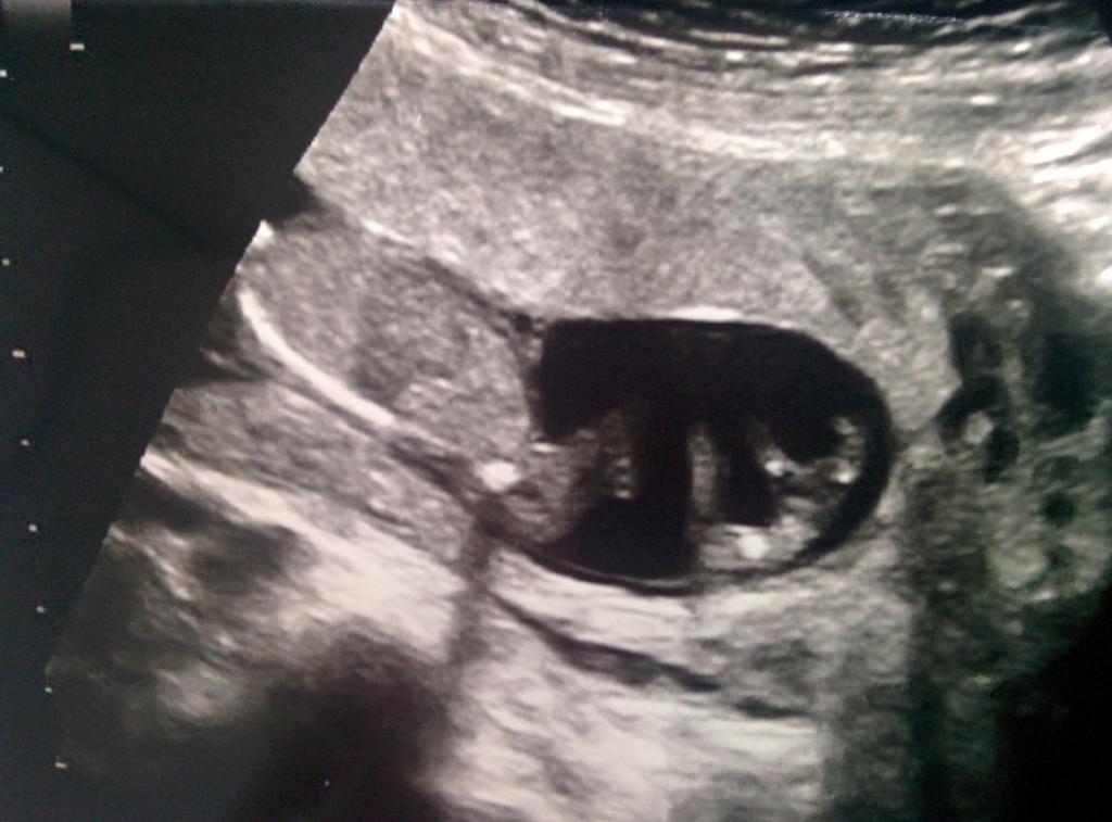 Name:  13.5weeks.jpg
Views: 1985
Size:  74.4 KB