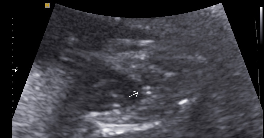 Name:  BABY_Potty edited.jpg
Views: 281
Size:  71.7 KB