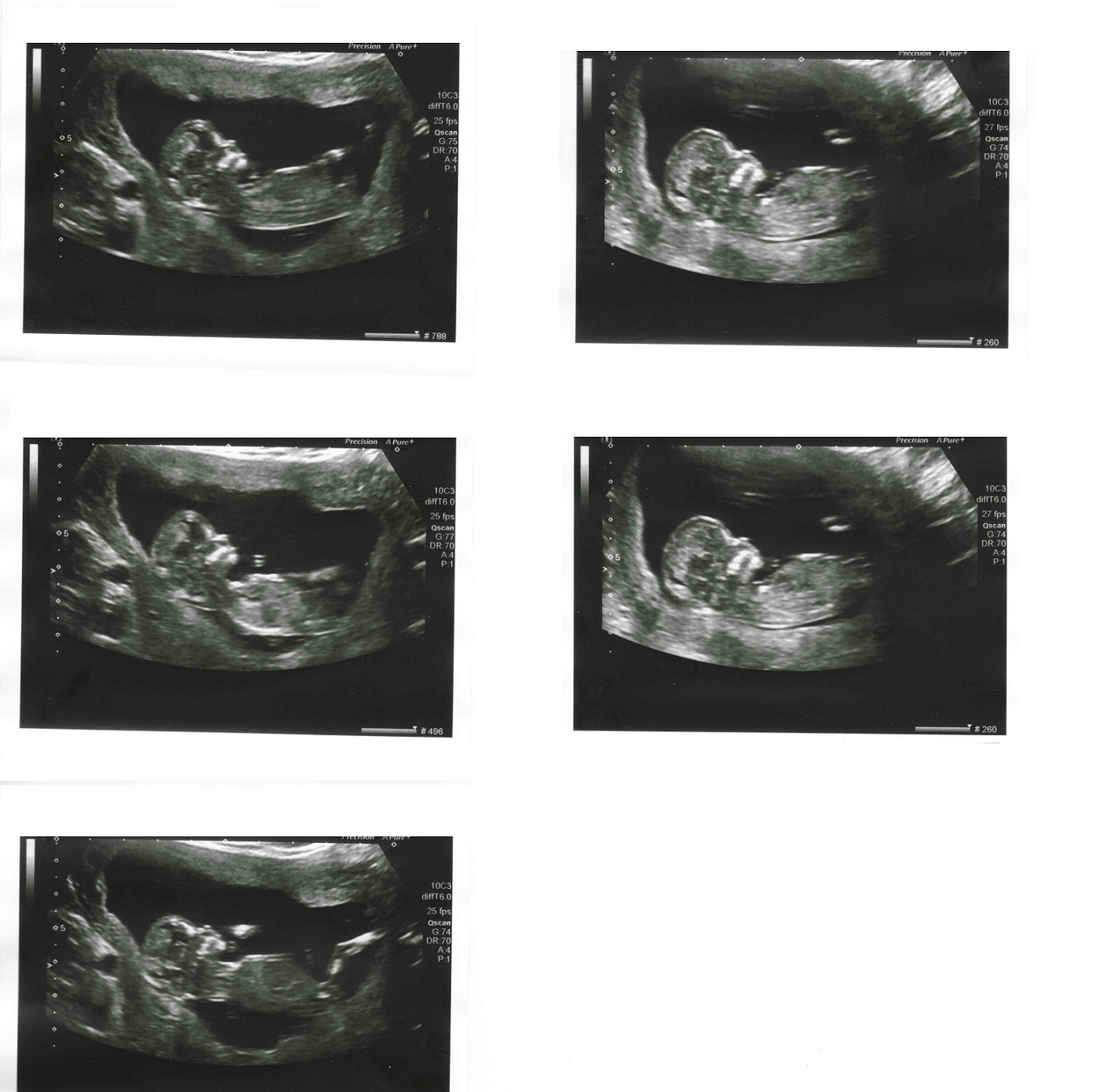 Name:  baby12w2d(1).jpg
Views: 201
Size:  289.3 KB