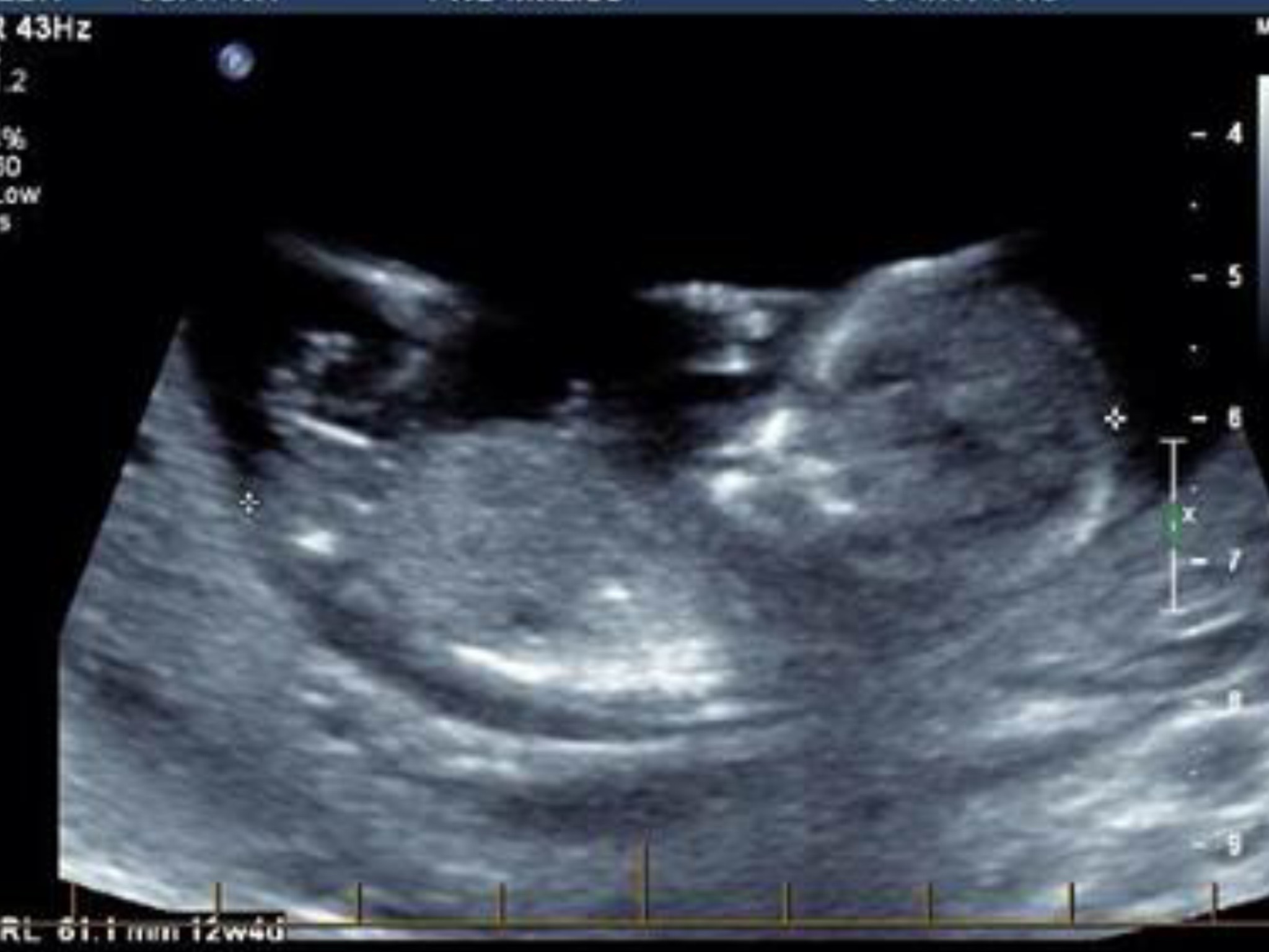 Name:  image.jpg
Views: 5885
Size:  246.2 KB