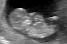 Name:  11weeks 2.jpg
Views: 314
Size:  32.4 KB