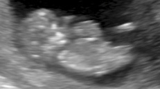 Name:  11weeks 4.jpg
Views: 317
Size:  30.2 KB