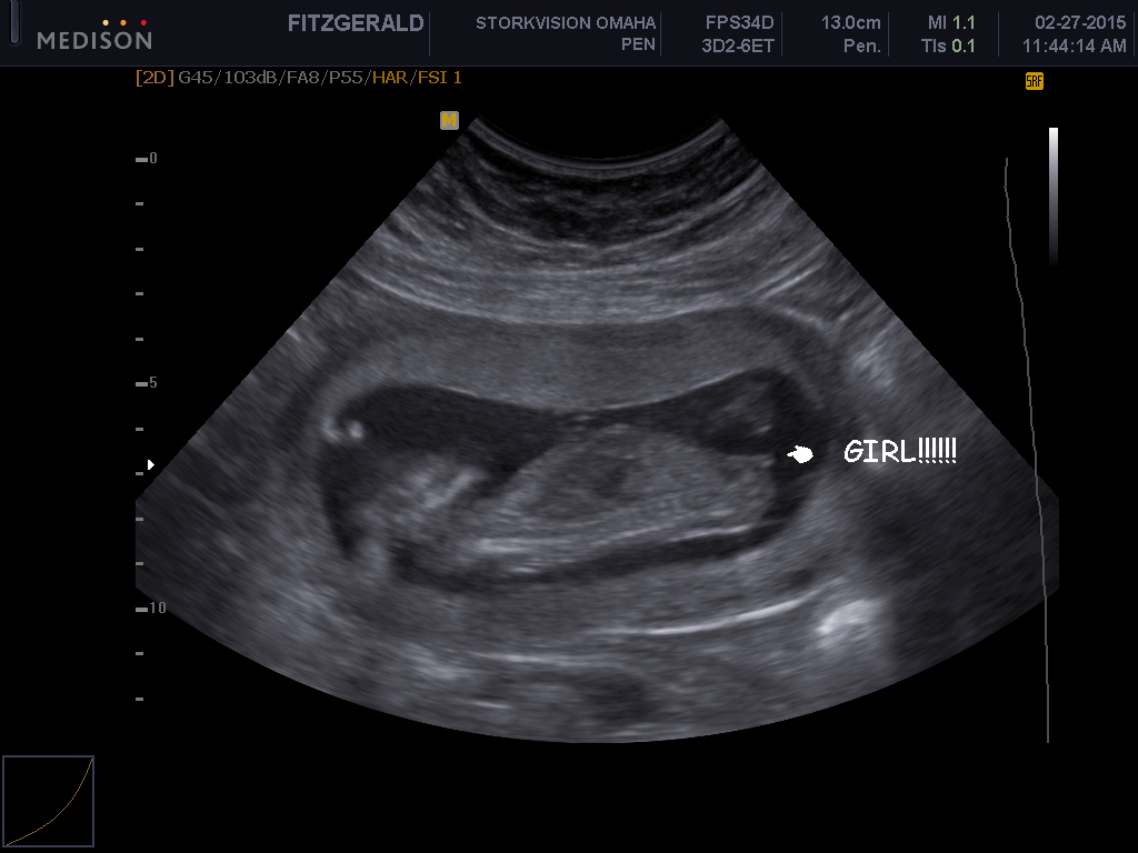 Name:  BABY_0018.JPG
Views: 9304
Size:  171.4 KB