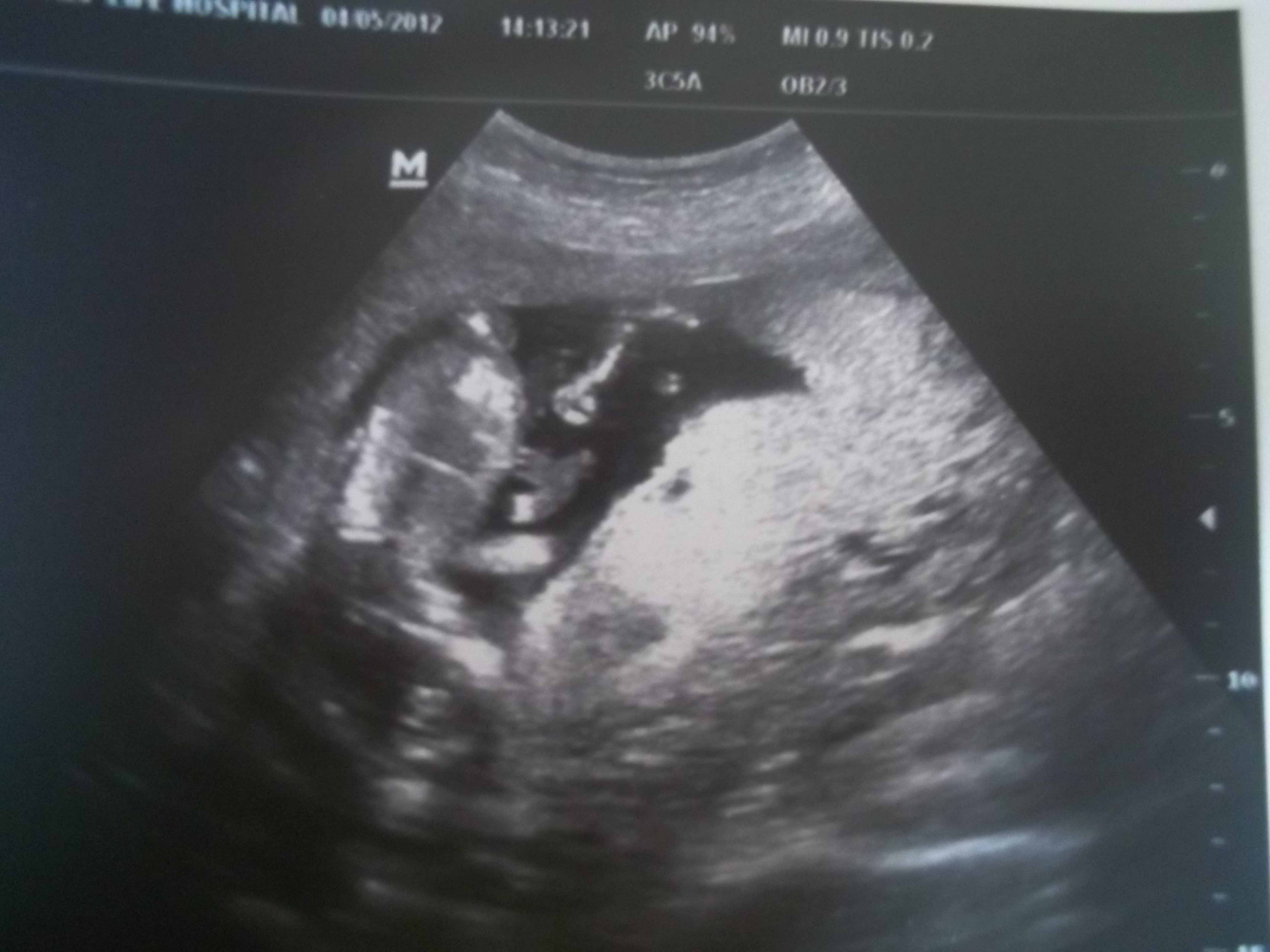 Name:  scan1.jpg
Views: 144
Size:  354.2 KB