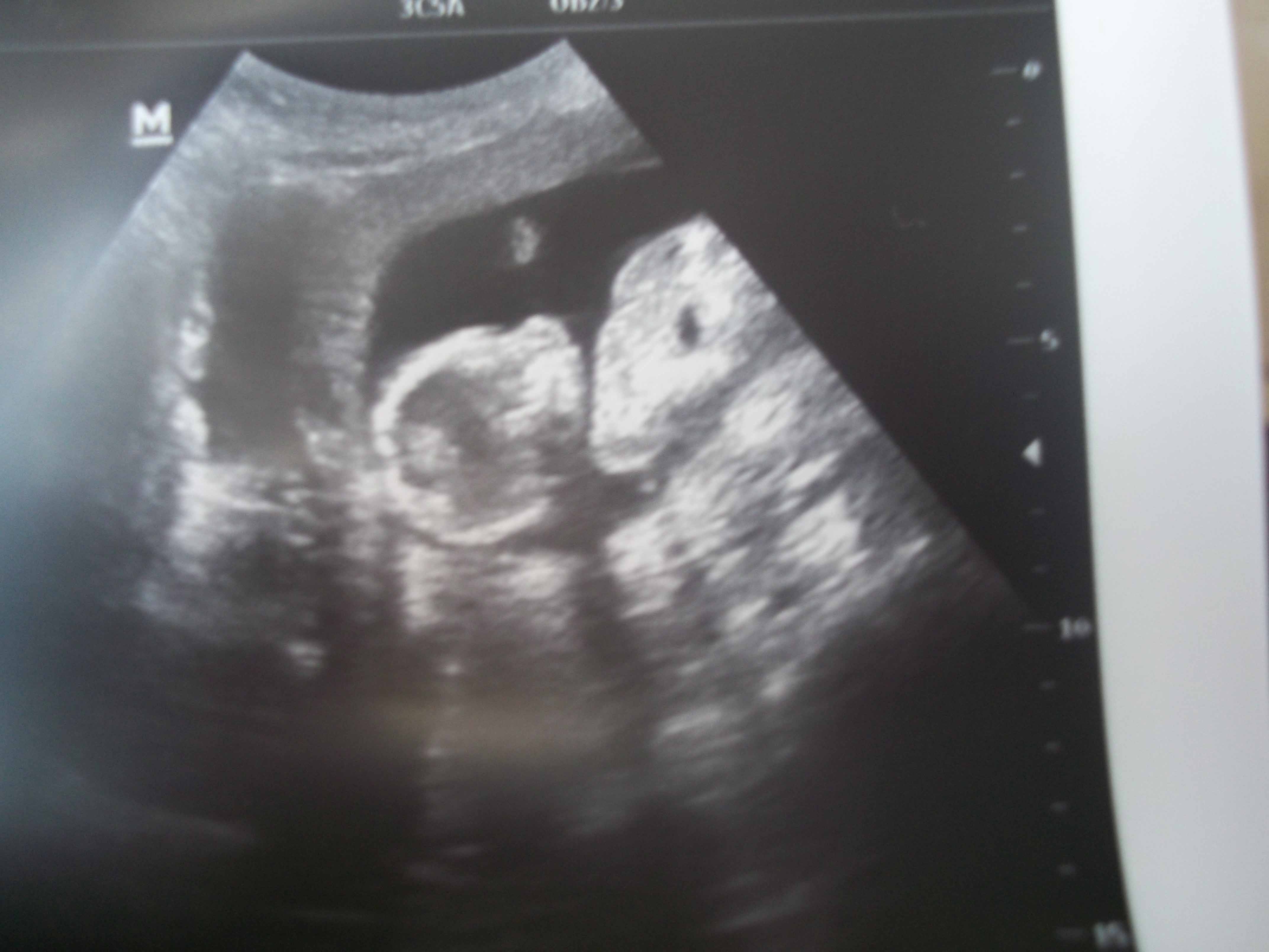 Name:  scan2.jpg
Views: 132
Size:  326.4 KB