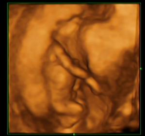 Name:  picture3.jpg
Views: 919
Size:  9.9 KB