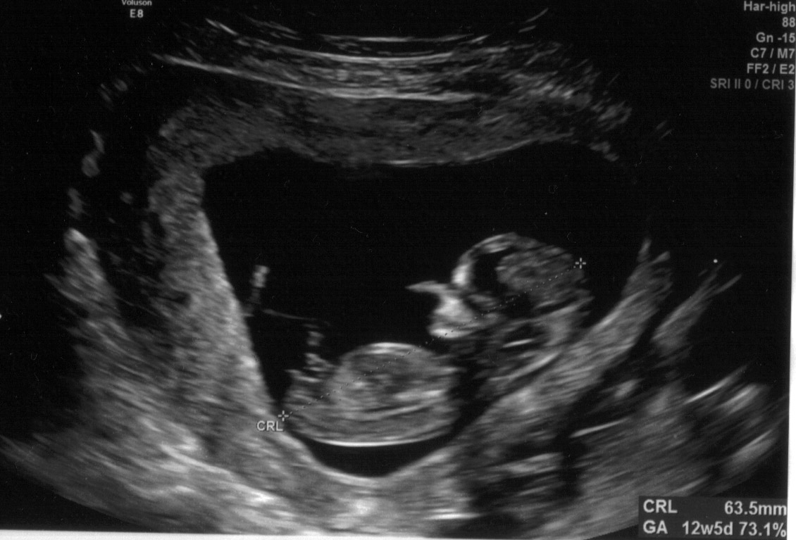 Name:  1scan2.jpg
Views: 5975
Size:  162.4 KB