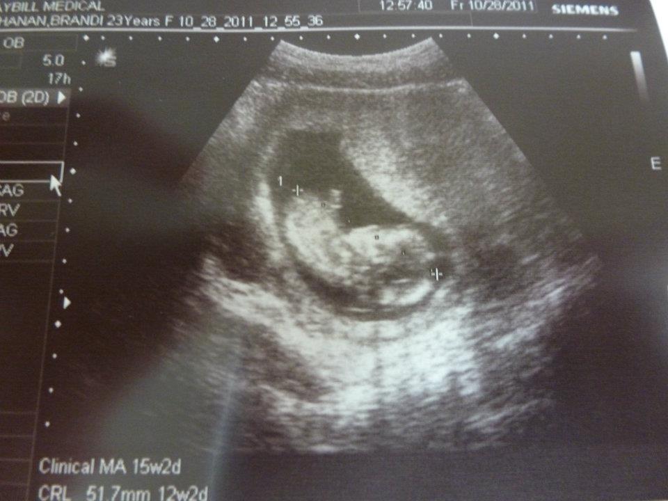 Name:  baby.jpg
Views: 1162
Size:  74.5 KB