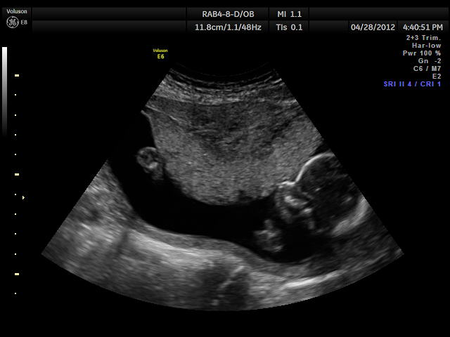 Name:  baby boy_16.jpg
Views: 169
Size:  30.8 KB