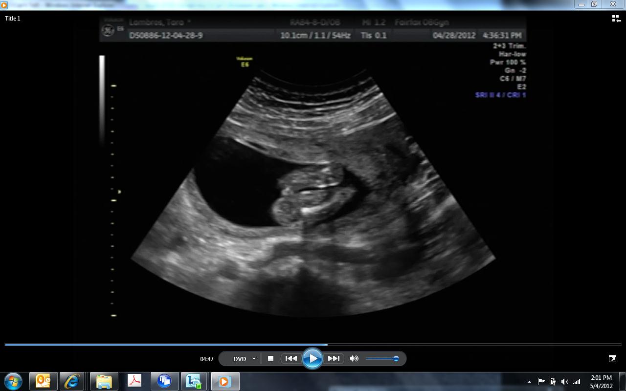 Name:  Baby1.jpg
Views: 164
Size:  68.5 KB