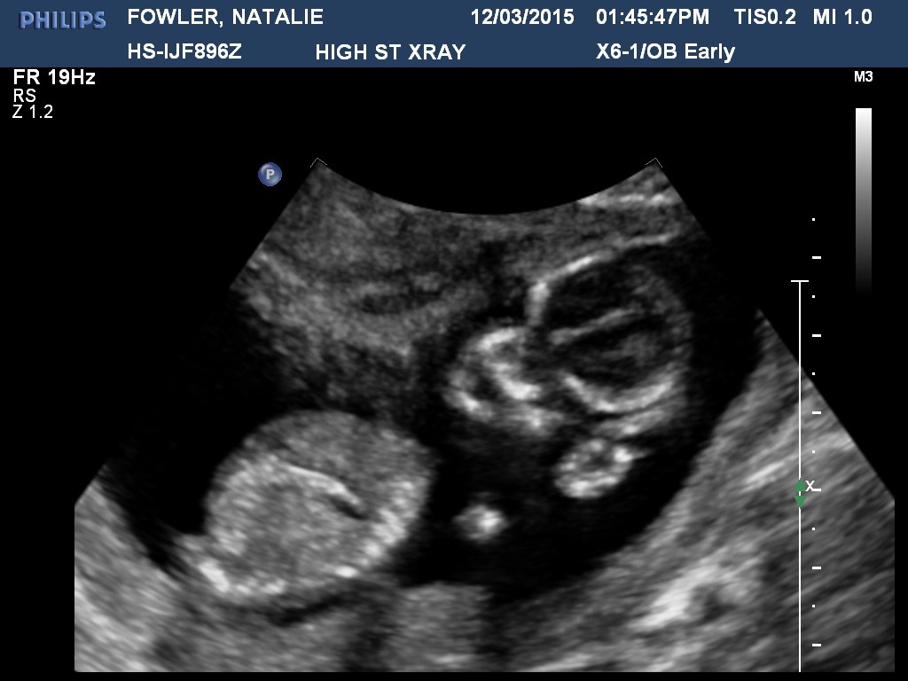 Name:  FOWLERNATALIE20150312134547557.jpg
Views: 4810
Size:  152.6 KB