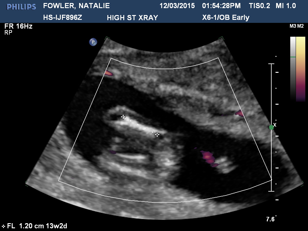 Name:  FOWLERNATALIE20150312135428739.jpg
Views: 1392
Size:  162.9 KB