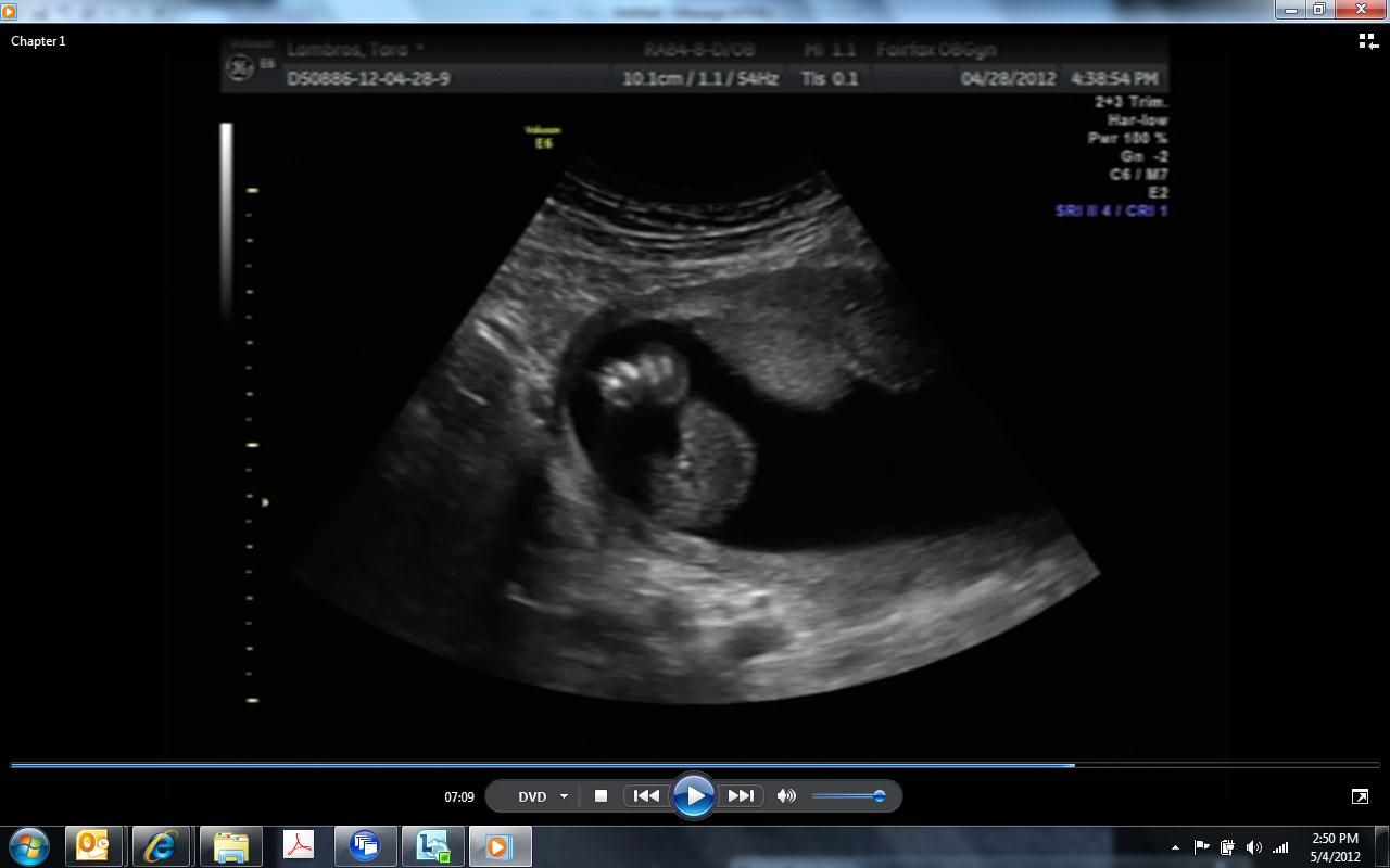 Name:  Baby2.jpg
Views: 189
Size:  63.8 KB