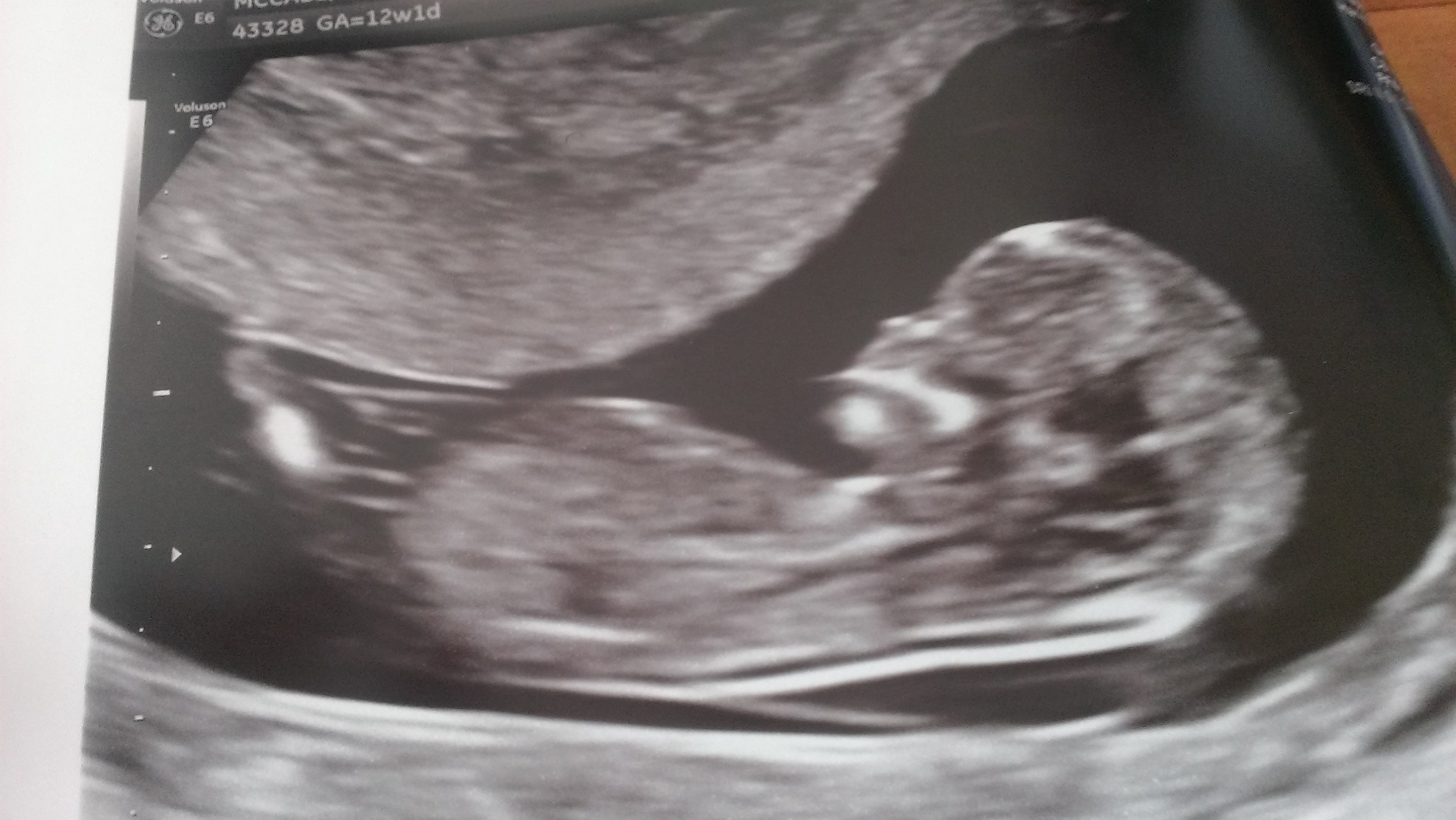 Name:  baby3.jpg
Views: 389
Size:  1.23 MB