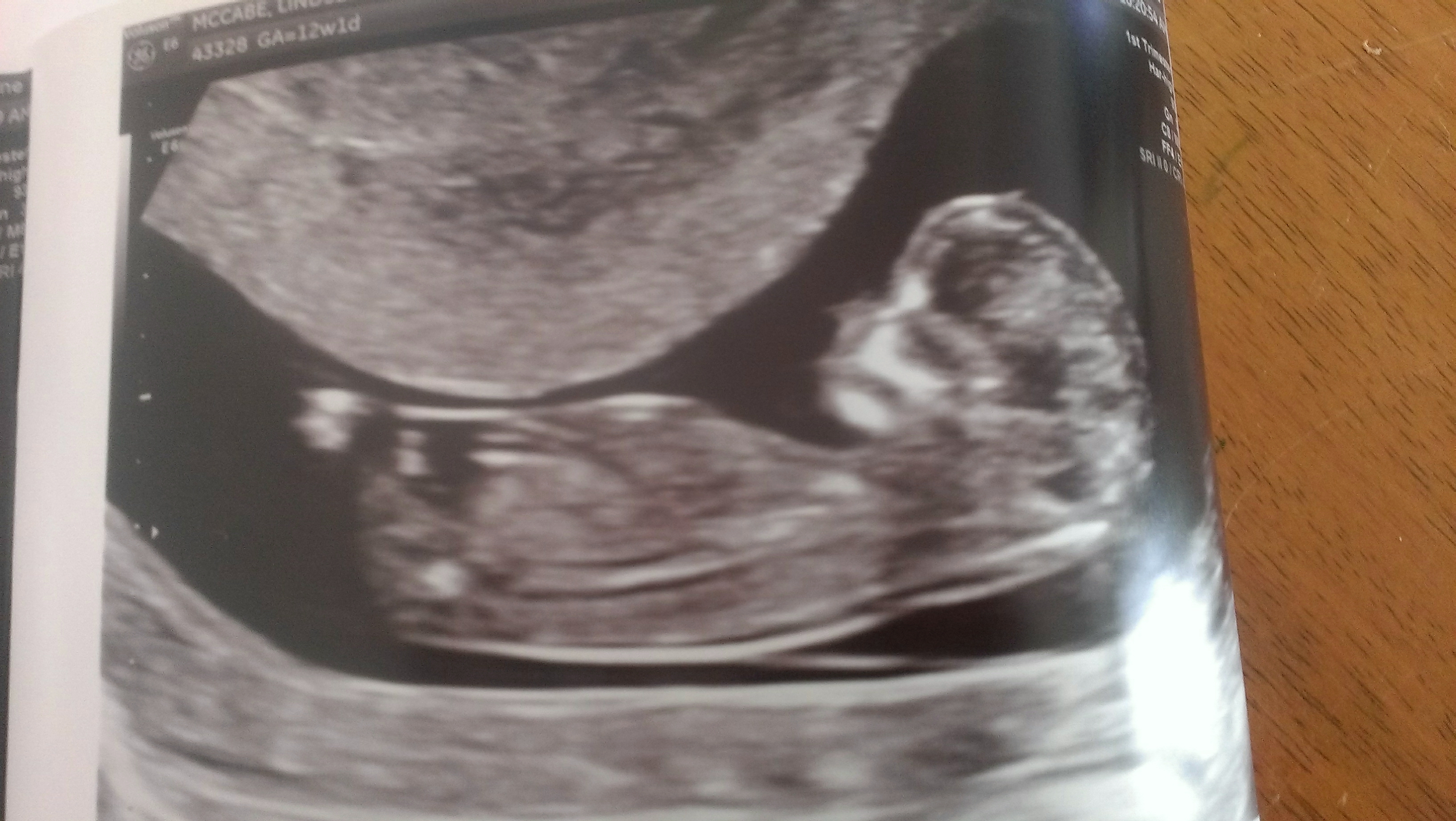 Name:  babe3.jpg
Views: 155
Size:  2.54 MB