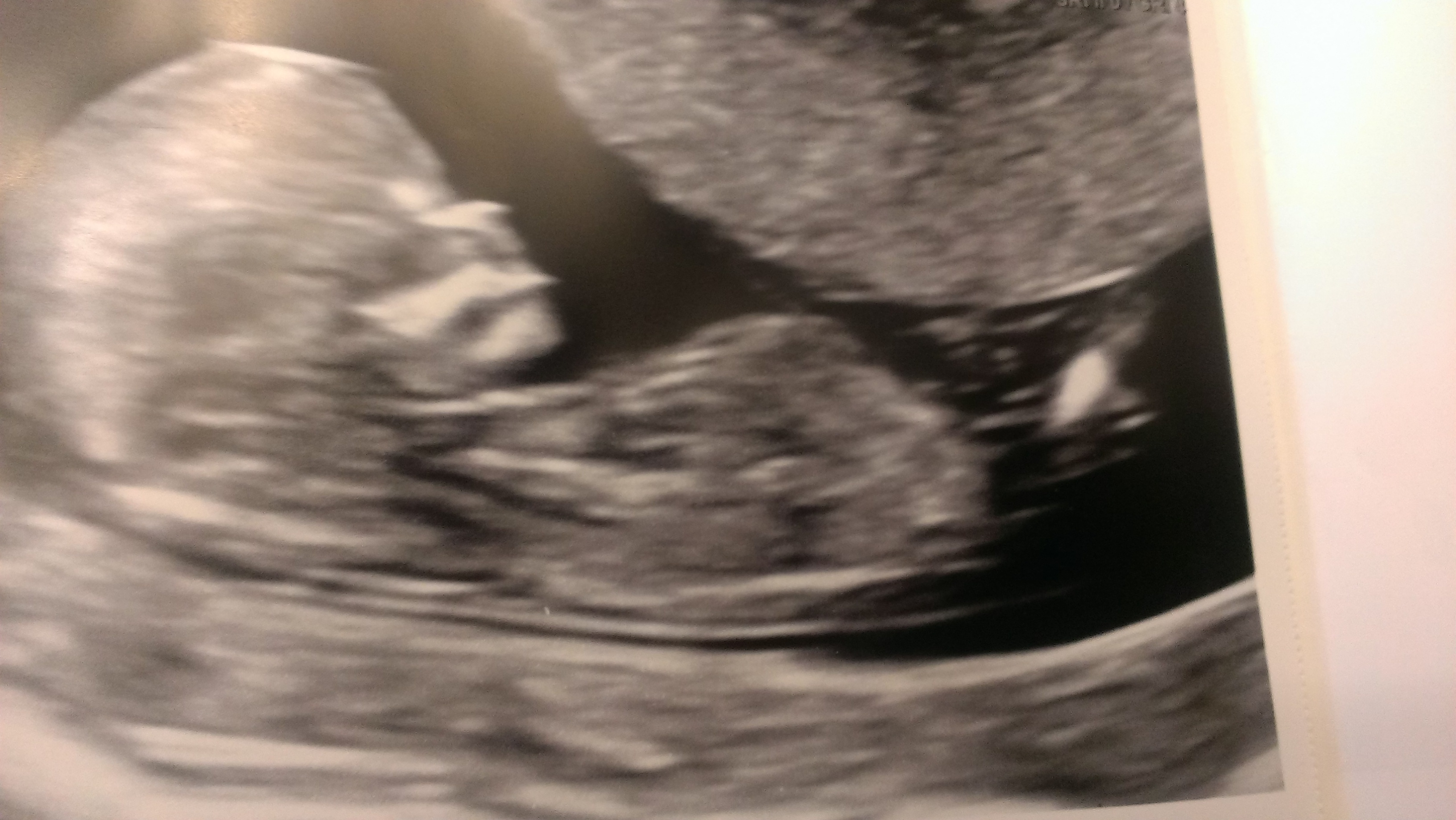 Name:  baby33.jpg
Views: 205
Size:  1.13 MB