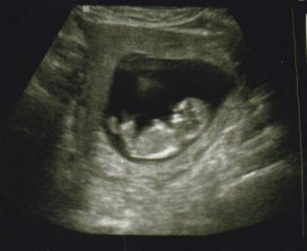 Name:  baby3.jpg
Views: 85
Size:  11.1 KB
