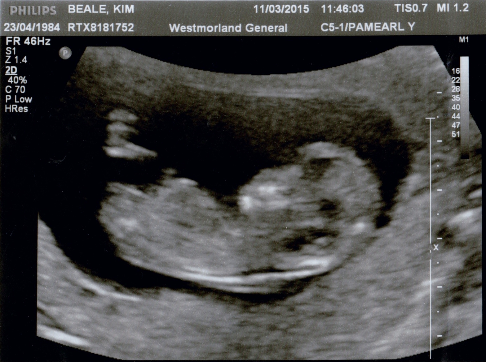 Name:  Scan-150316-0004.jpg
Views: 709
Size:  1,014.0 KB