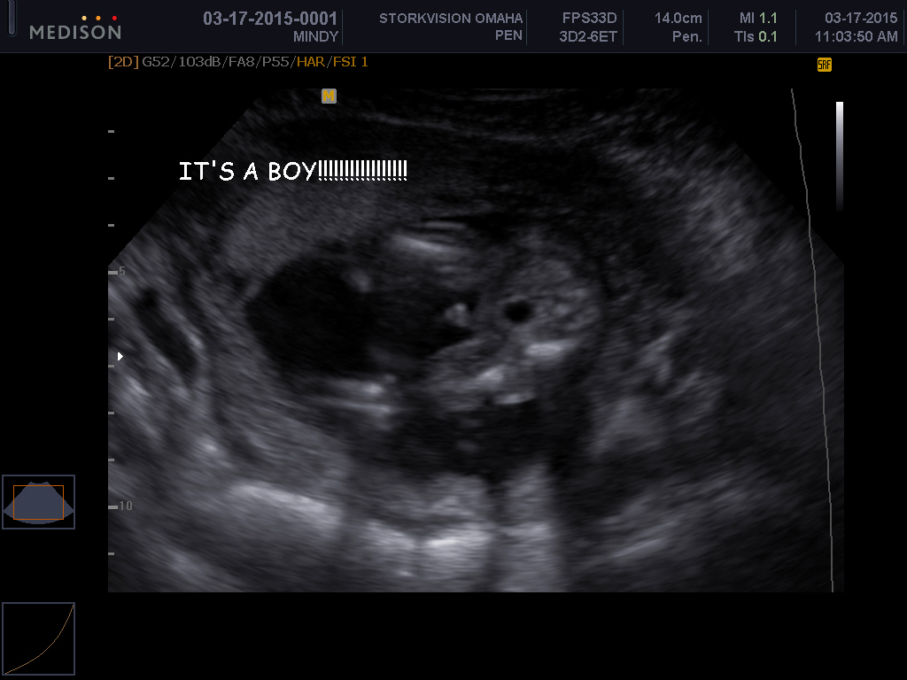 Name:  BABY_0000.JPG
Views: 84
Size:  189.5 KB