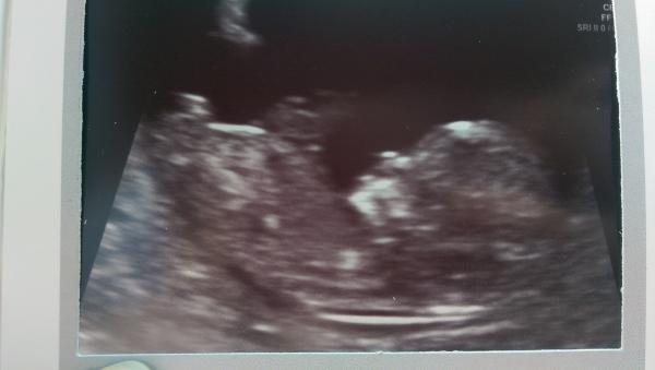 Name:  baby 12 weeks.jpg
Views: 720
Size:  18.1 KB