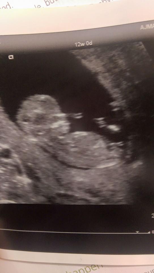 Name:  baby 12+2.jpg
Views: 244
Size:  36.5 KB