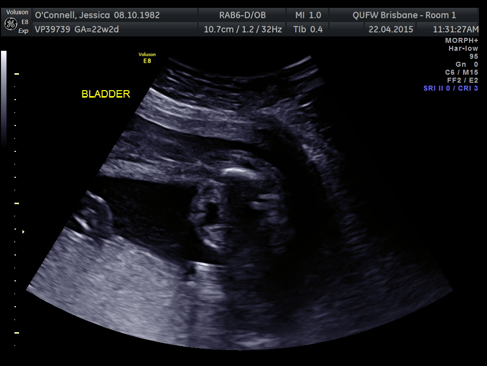 Name:  Bub #4 031.jpg
Views: 391
Size:  191.4 KB