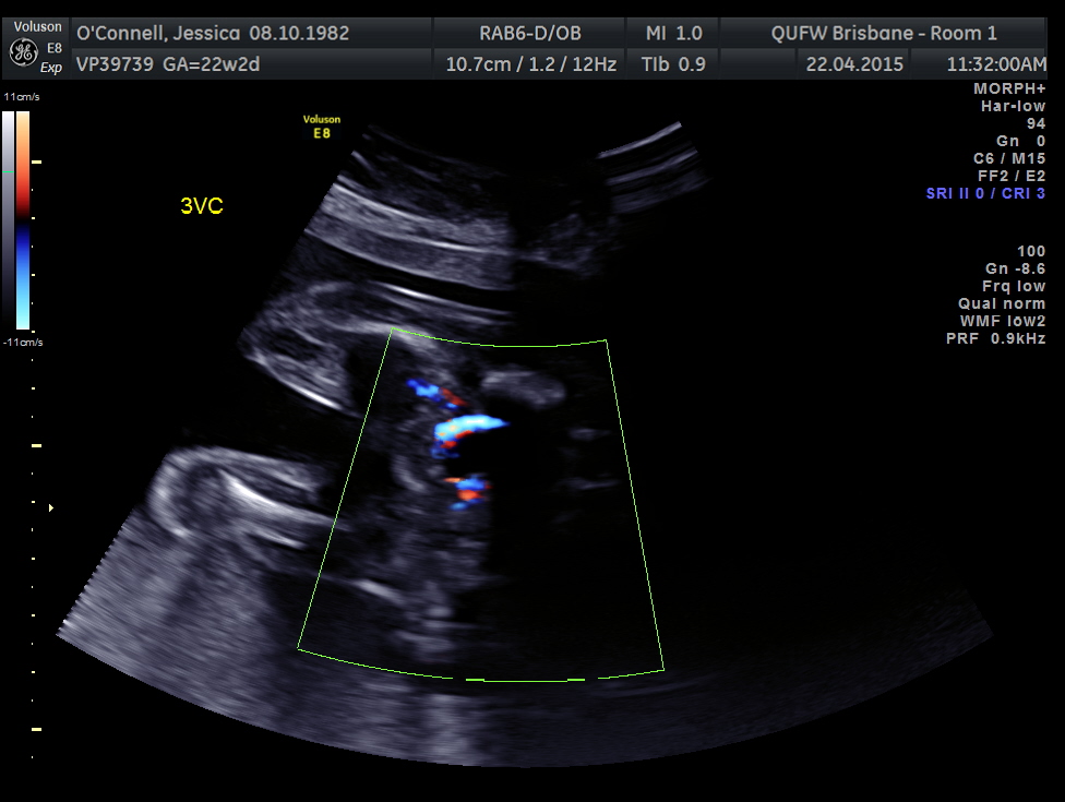 Name:  Bub #4 033.jpg
Views: 387
Size:  188.7 KB