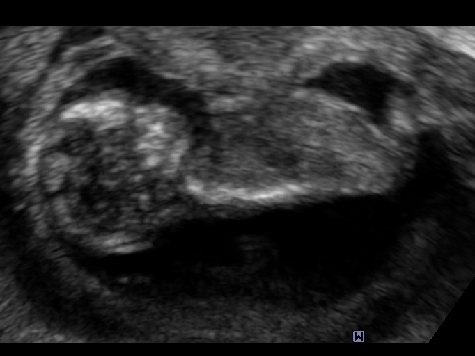 Name:  profile1.jpg
Views: 537
Size:  62.8 KB