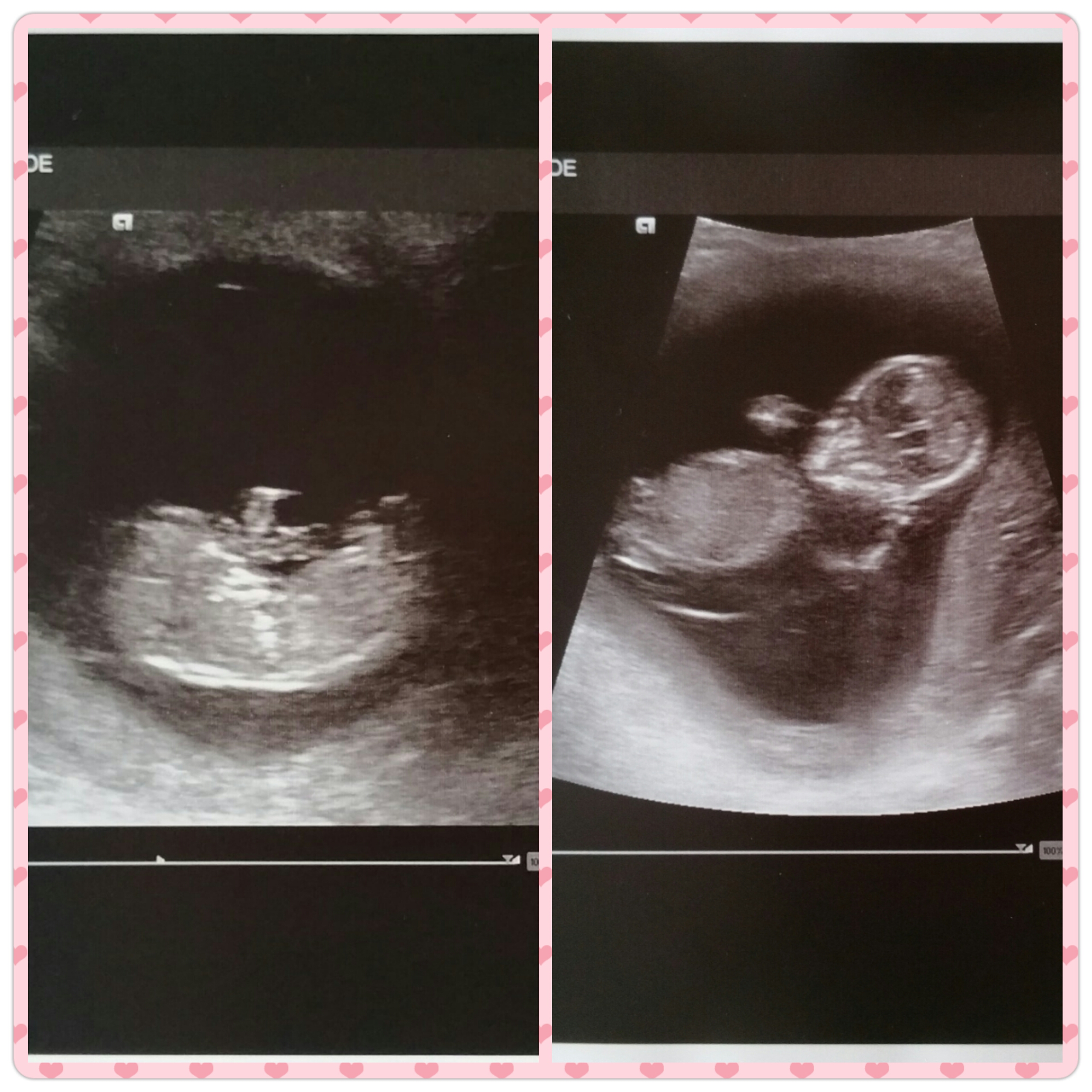 Name:  PhotoGrid_1429951657167.jpg
Views: 151
Size:  2.41 MB