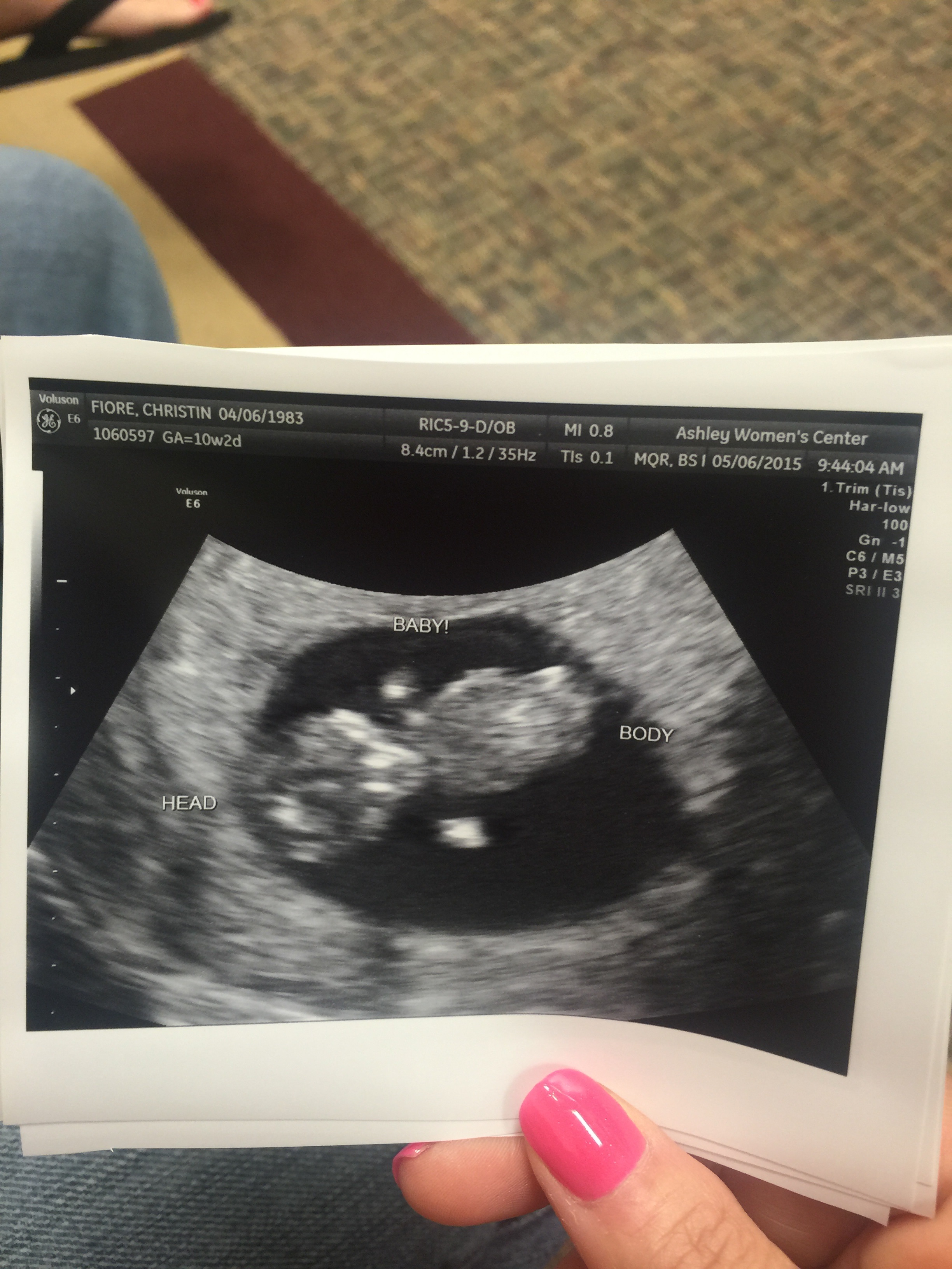 Name:  Baby.jpg
Views: 3525
Size:  1.47 MB