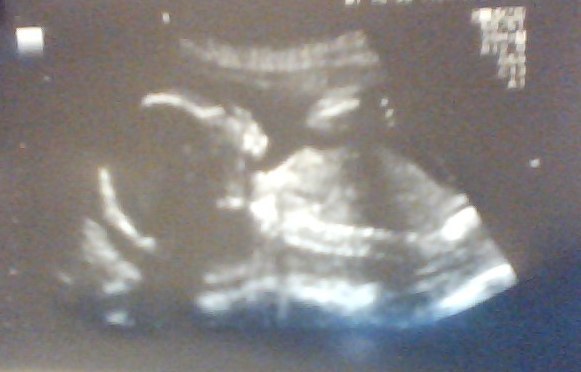 Name:  Snapshot_20120509.jpg
Views: 923
Size:  30.4 KB